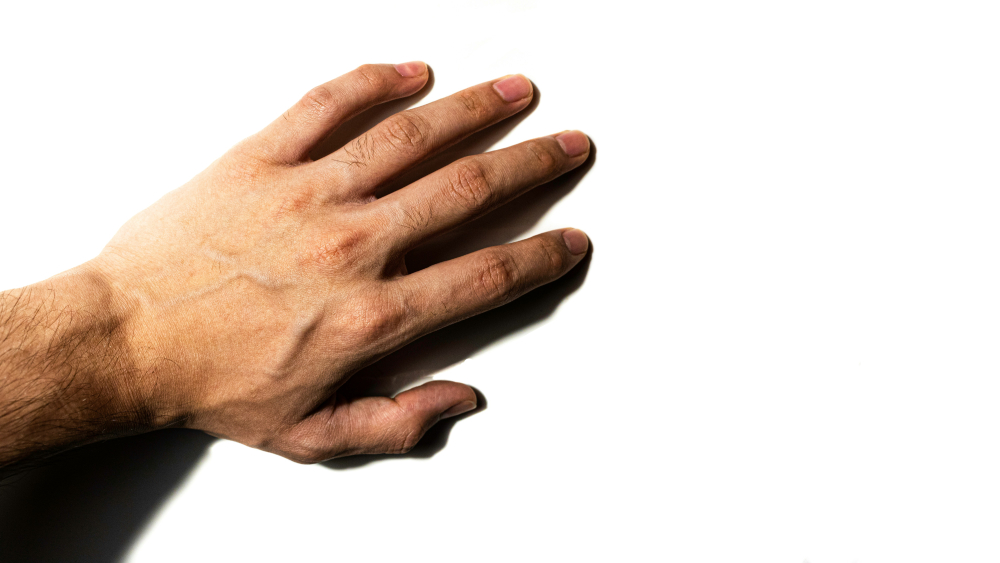 Aanraken van je mannelijk geslachtsdeel, verbreker van wudu? | Fitrah Tawheed